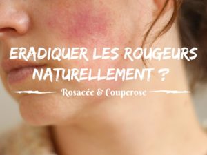 comment_traiter_les_rougeurs_naturellement