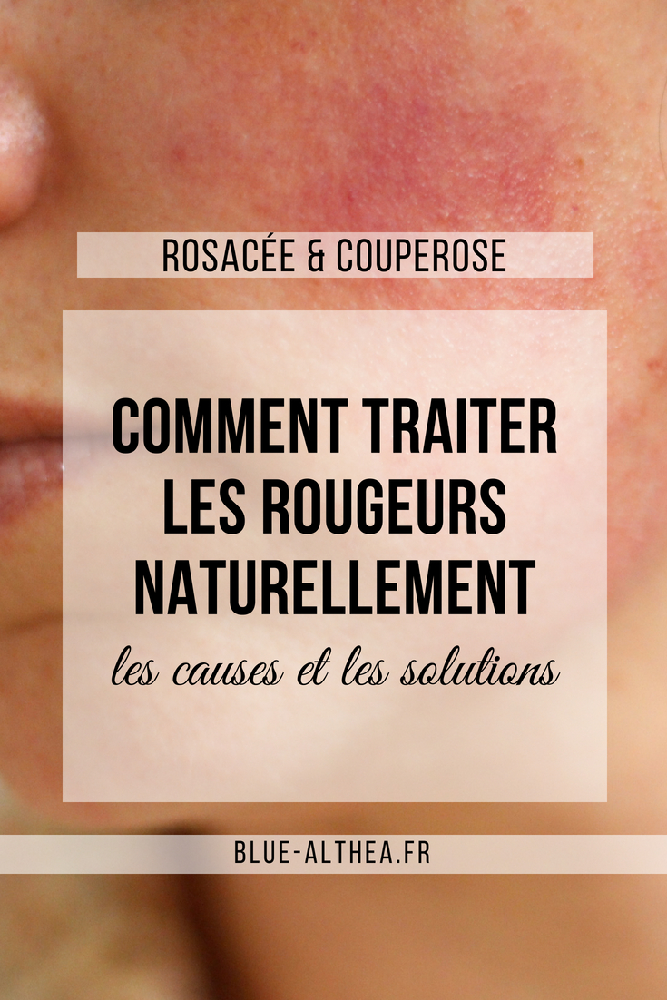 Ici on parle comment traiter naturellement les rougeurs, rosacée et couperose. Je t'explique quels sont les causes et les solutions naturelles qui peuvent t'aider à t'en débarrasser !